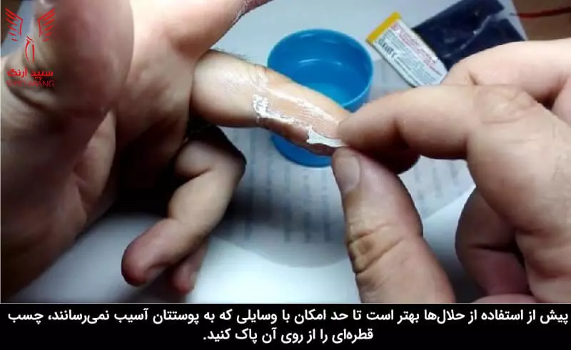 حلال چسب قطره ای از روی دست و ناخن و سایر قسمت‌های پوست